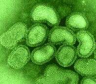 PSP.Brick - Il primo virus per PSP