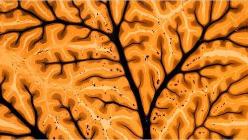 Google simula il cervello umano tramite computer