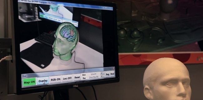 La Kinect potrebbe entrare nelle sale operatorie