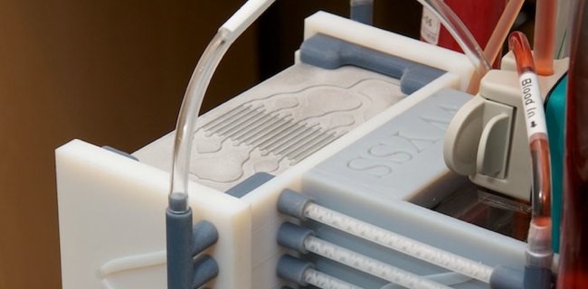 Harvard porta la milza in un chip