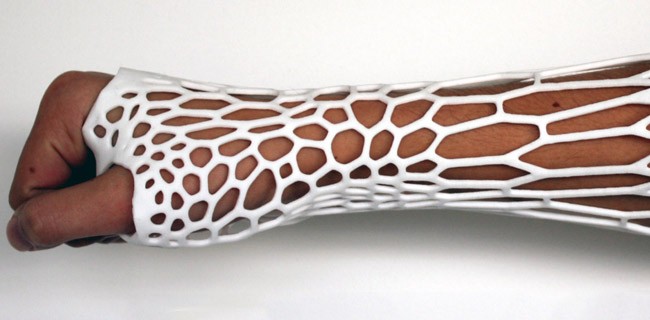 Gessi stampati in 3D per riparare le ossa rotte