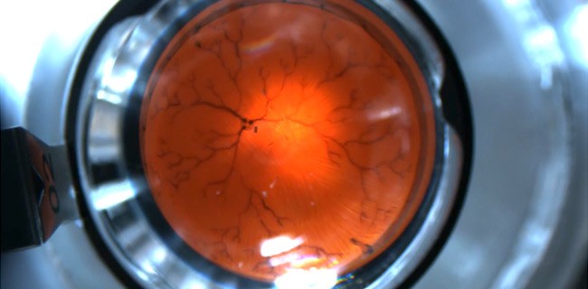 Un nanobot per chirurgo