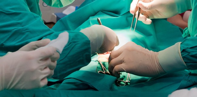 Trapianto di testa: fantasia o realtà?