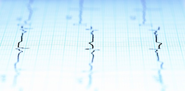 Gli smartphone possono rilevare i terremoti