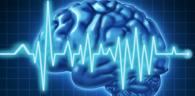 Elettroencefalogramma contro i furti d'auto?