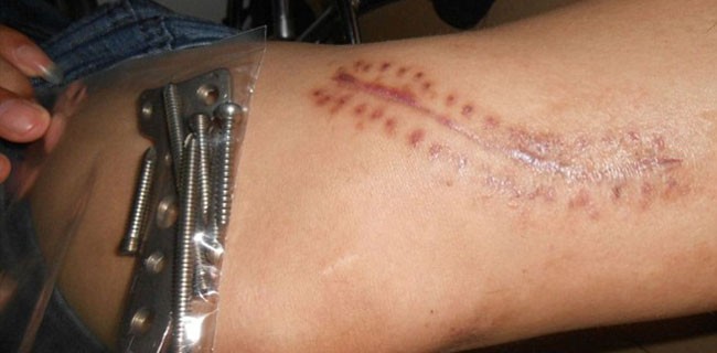 Partner Apple accusato di sfruttamento: foto shock