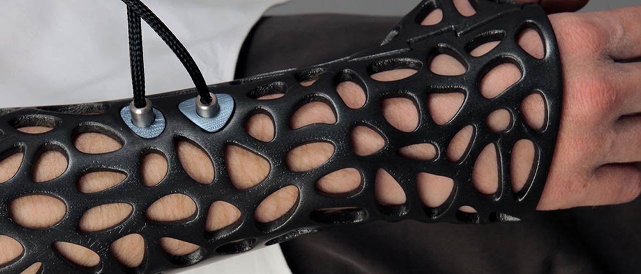 Osteoid, gesso stampato in 3D con ultrasuoni