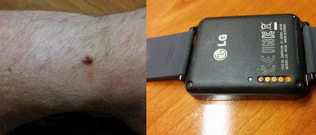LG G Watch: problema ai contatti per la ricarica