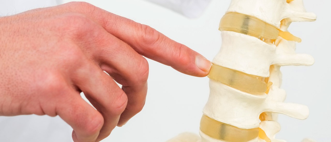 Primo impianto di una vertebra stampata in 3D