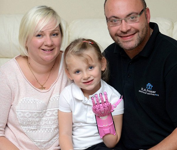 Una bambina britannica con una mano colorata stampata in 3D