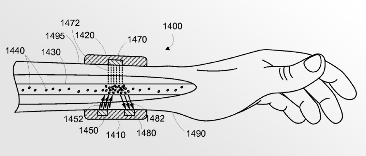 Google brevetta un bracciale contro il cancro