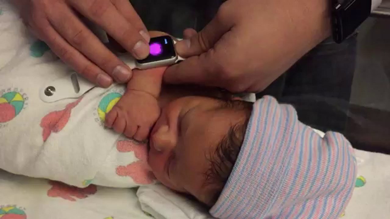 Apple Watch - Battito Neonato