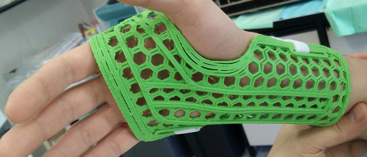 WASP: stampa 3D per tutori e parti di teca cranica