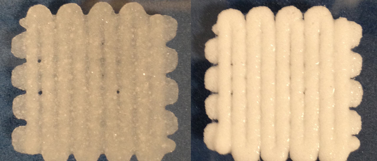 Stampanti 3D per riparare le ossa rotte