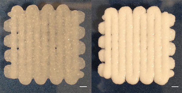 La "schiuma" stampata in 3D per riparare le fratture ossee