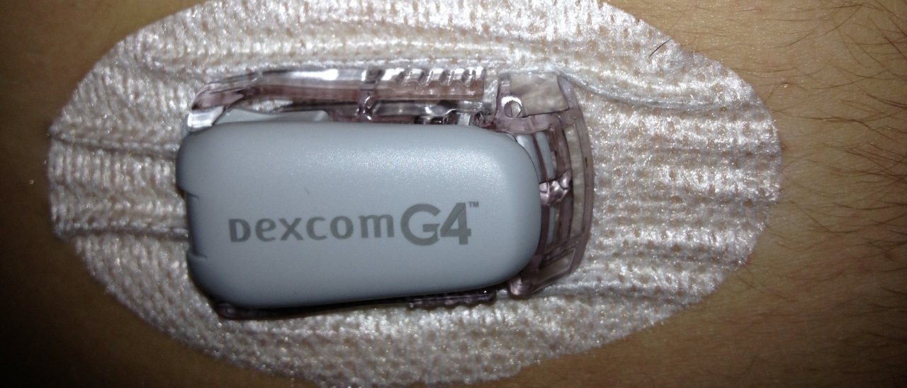 Google progetterà dispositivi per diabetici