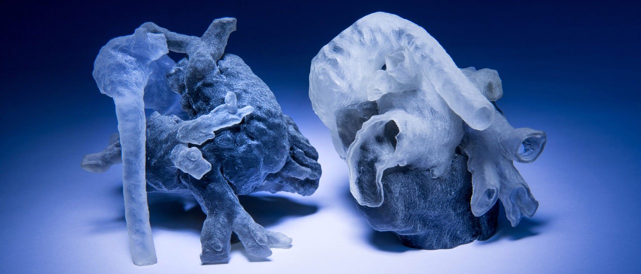 Il cuore, stampato in 3D