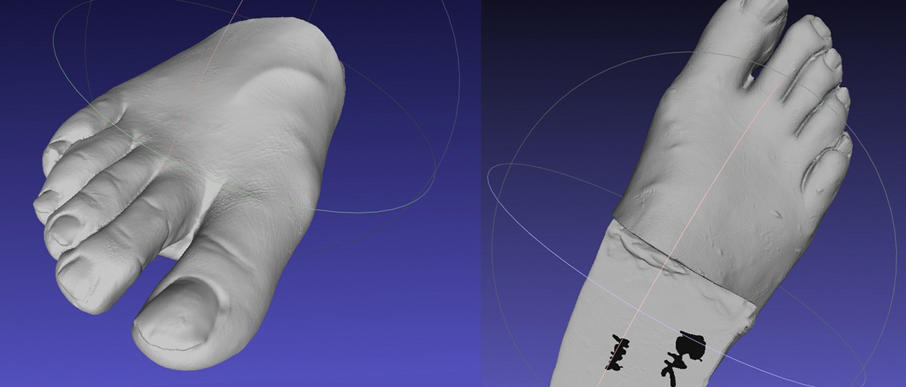 Protesi e stampanti 3D: il progetto di Erica Buzzi