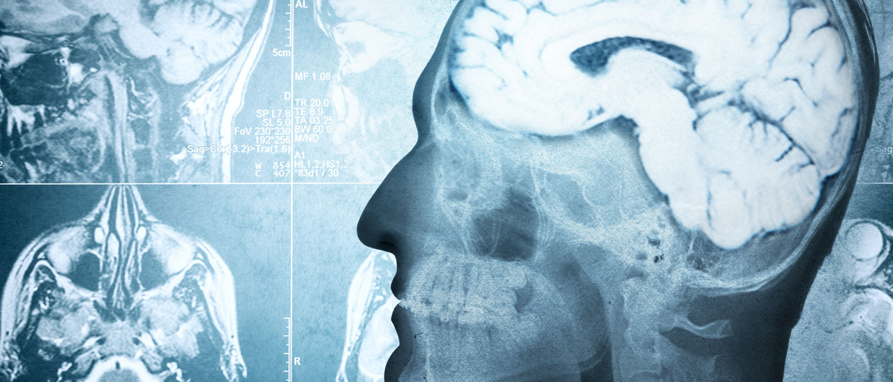 La morte cerebrale sarà reversibile?