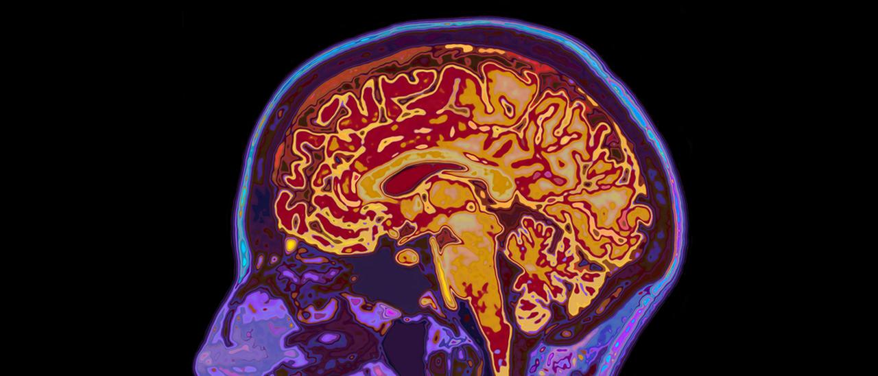 Questa intelligenza artificiale legge la mente