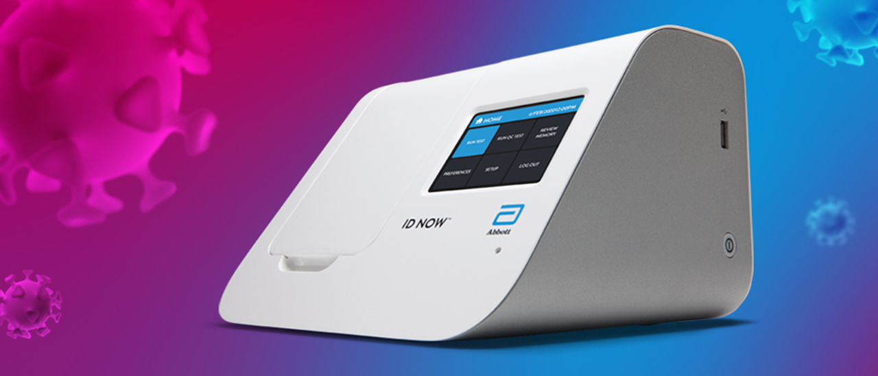 Coronavirus, un test lo diagnostica in 5 minuti