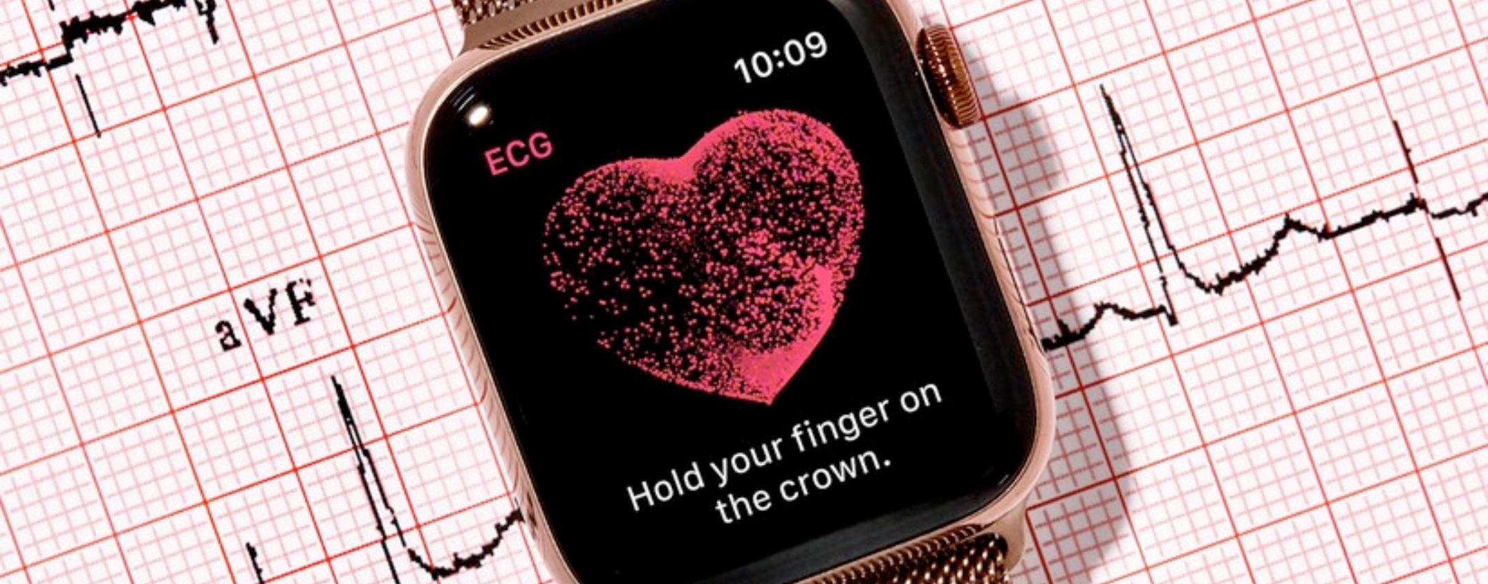 Apple Watch salva una donna da un coagulo di sangue ad alto rischio