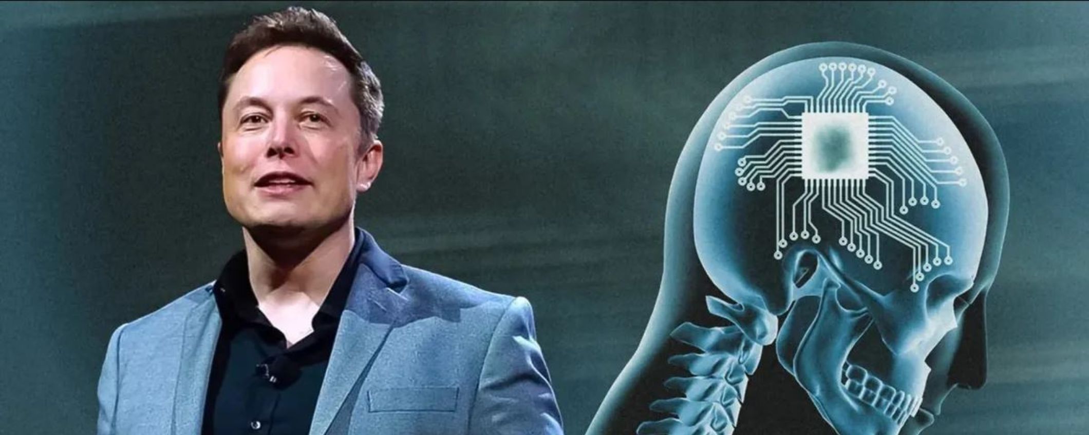 Neuralink: il racconto della prima persona con un chip nel cervello