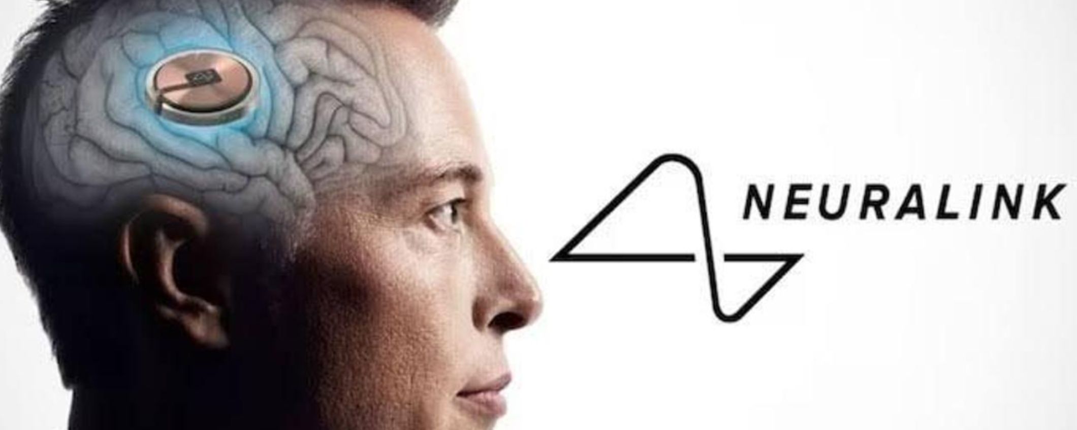 Elon Musk: i chip cerebrali Neuralink manderanno in pensione gli smartphone